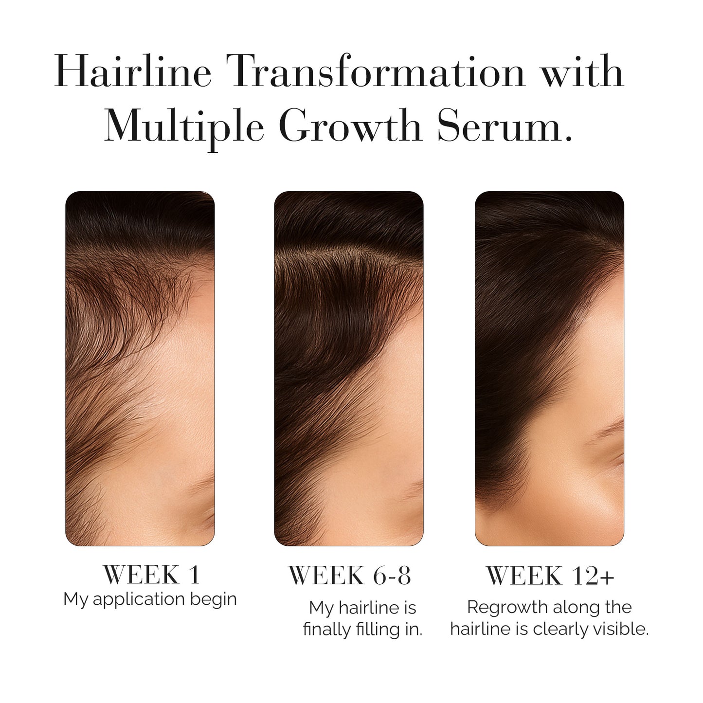 Multiple Growth Serum