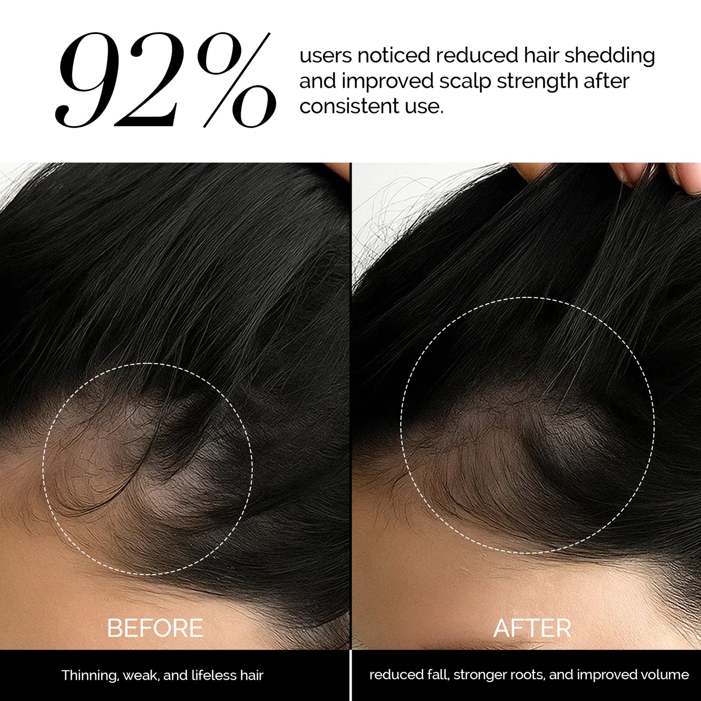 La Chevelure Anti Hair Loss Treatment