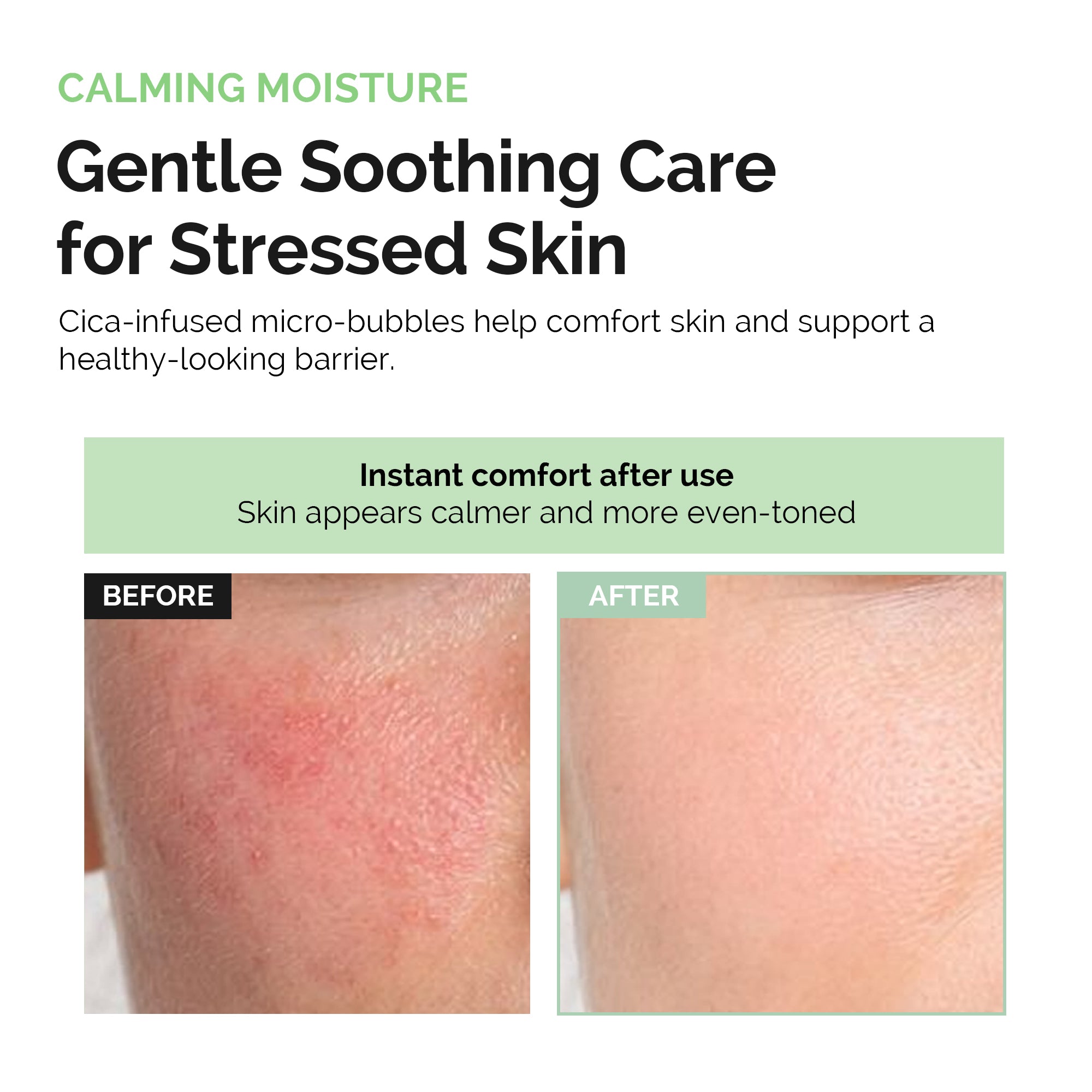Dluxkin Bubble Mask