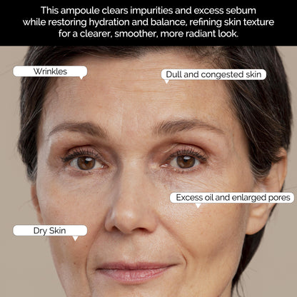 Peau D’art Clarifying Ampoule ( Goody Dry Skin)