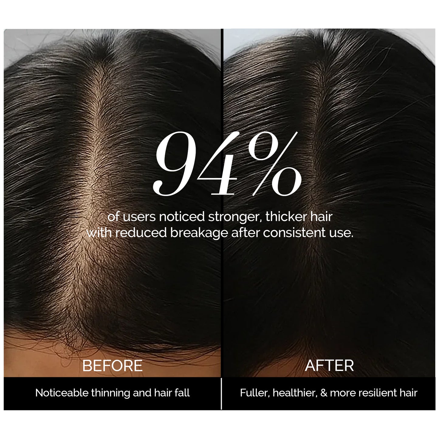 La Chevelure Anti Hair Loss Shampoo