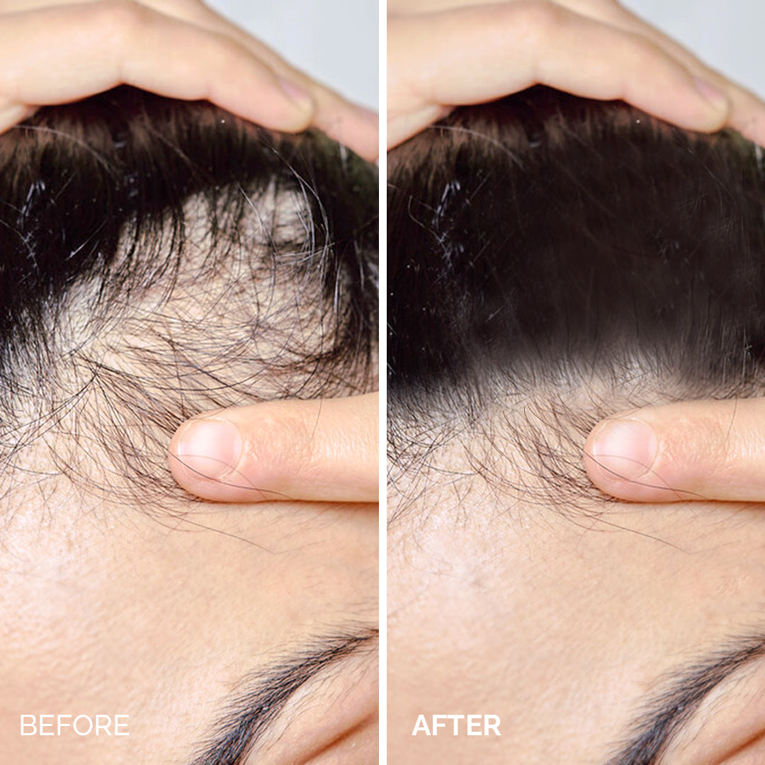 La Chevelure Anti Hair Loss Treatment