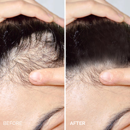 La Chevelure Anti Hair Loss Toner